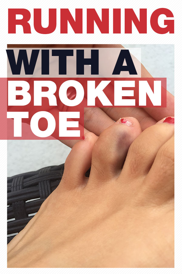 run on broken toe