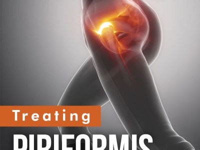 Piriformis Syndrome