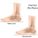 Running with Flat Feet