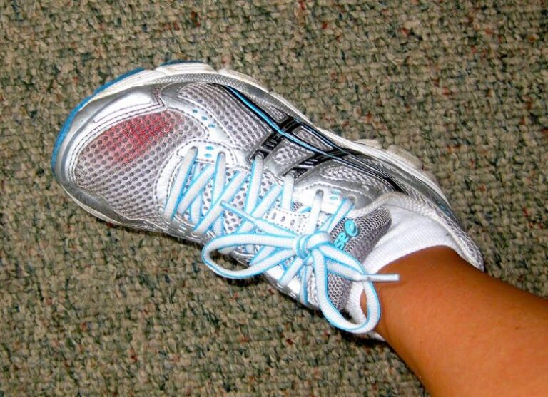 Runner's Toe Prevention And 7 Easy Tips To Keep Running - Runtothefinish