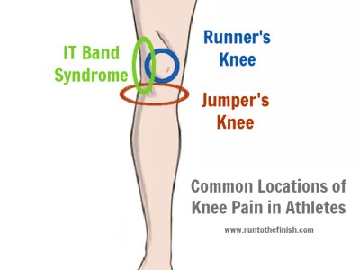 Runner's knee vs jumper's knee