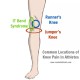 Runner's knee vs jumper's knee